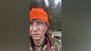 GRAPHIC: Woman survives vicious bear attack while