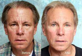 Doing These Two Things Will Naturally Make You Look Younger And Will Make You Stop Aging Now Issuewire