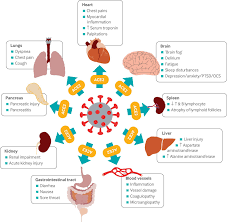 But pain in these areas is often unrelated to your kidneys. Long Covid Mechanisms Risk Factors And Management The Bmj
