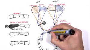 Visual Pathway And Lesions