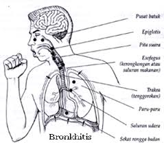 Gejala Bronkhitis Akut