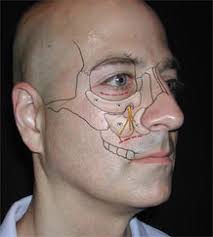 Chief of craniofacial surgery at mgh as well as operating his private dr. World Renowned Bespoke Cosmetic Plastic Surgeon Boston Dr Michael Yaremchuk