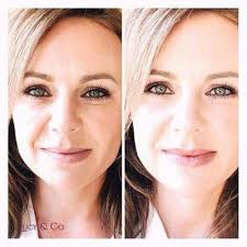 Cottonwood Laser Care, 100 Cottonwood Ct, Ste 150, Eagle, ID 83616, US