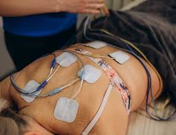 Image result for Electrical Stimulation Therapy