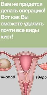 как избавиться от неприятного запаха изо рта из за желудка Vam Ne Pridetsya Delat Operaciyu Vot Kak Vy Smozhete Udalit Pochti Vse Vidy Kist Body Health Herbal Medicine Health Fitness