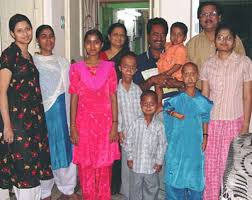 Image result for progeria case in bihar