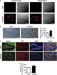 Apr 13, 2021 · christabel chua av / 2sincerity'10★ : Amyloid B 1 42 Oligomer Accelerates Senescence In Adult Hippocampal Neural Stem Progenitor Cells Via Formylpeptide Receptor 2 Cell Death Disease