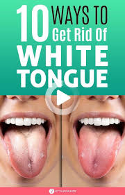 The very common cause of a white tongue is no or poor oral hygiene. 10 Ways To Get Rid Of White Tongue And Make It Healthier Tongue Health White Tongue Health Signs