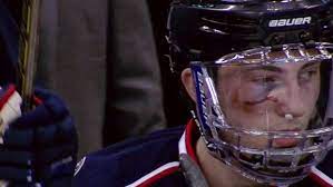 Zachary werenski (born july 19, 1997) is an american professional ice hockey defenseman who plays for the columbus blue jackets of the national. Werenski Shares Pic Of Eye After Taking Puck To The Face Torts Praises His Toughness In Nsfw Way Article Bardown