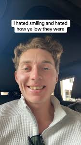 How Long Does It Take to Get Off Clears and Go Onto White