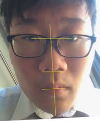 When you get these tissues back to their normal position, you will be able to reshape the rest of the face. If My Whole Face Is Asymmetrical Must I Get A Bunch Of Surgery To Make It All Even Quora