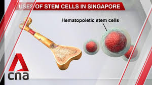 Your direct link to cna's content and journalists. Family Of Covid 19 Patient In Singapore Appeals To Moh To Consider Stem Cell Therapy Youtube