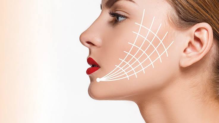 Thread Lift | Aesthetics By Dr Ali Soueid