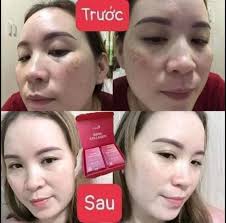 Profile for Collagen Bena Thanh Xuân Cho Làn Da