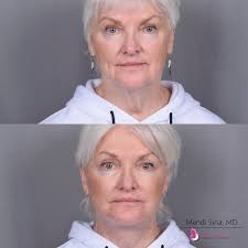 Nuance Aesthetics & Plastic Surgery