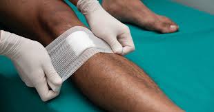 Perkongsian doktor ini amat bermanfaat untuk menanganinya. Tanda Jangkitan Kuman Pemakan Organ Hanya Kerana Gigitan Serangga Theasianparent Malaysia