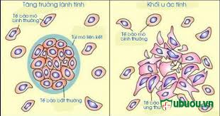Dân vn quên nhanh lắm với lũ xướng ca vô loài chẳng có gì không thể , như con cát phượng ấy nó bảo vệ thằng ấu dâm xong vẫn đi chửi người khác vô học và tặng người ta sách. Phan Biá»‡t 2 Loáº¡i U Tuyáº¿n Giap Theo Sá»± Ä'á»™t Biáº¿n Trong Gen Táº¿ Bao