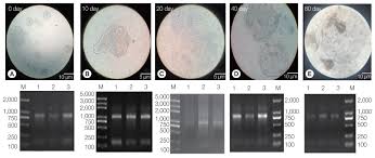 George lambert is exploring a run for governor. Transcriptomic Features Of Echinococcus Granulosus Protoscolex During The Encystation Process