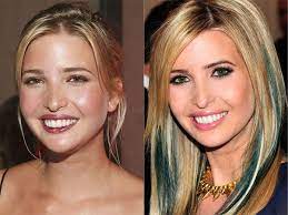 The former couple are also parents to two other kids, sons donald trump jr., 39, and eric trump, 33. Ivanka Trump Before And After Plastic Surgery Beauty Editor Hair Implants Ivanka Trump Cosmetic Surgery