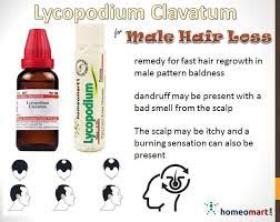 Lycopodium For Hair Loss In Males Homeopathy Medicine Homeopathy Homeopathy Treatment
