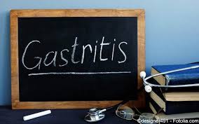 Gastritis Symptome Diagnostik Therapie Gelbe Liste