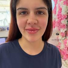 Glow Beauty Munique added a new photo.