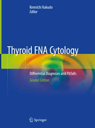 Nccn guidelines index table of contents discussion. Thyroid Fna Cytology Springerlink
