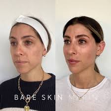 Bare Skin Marin (@bareskinmarin) · Kentfield, CA