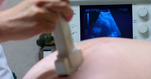Check spelling or type a new query. Pregnancy And Kidney Disease National Kidney Foundation