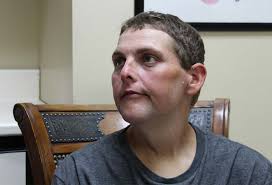 Dr. Now'ı bile şaşırtan değişim: Toplam 405 kilo verdiler!