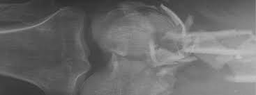 Image result for Genitourinary Trauma