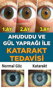 Ahududu Ve Gul Yapragi Ile Katarakt Tedavisi Saglik Dogal Saglik Saglik Ve Fitness