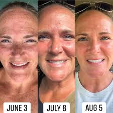 ODW vs Midnight Oil Serum One Drop Wonder Is one of our serums made with  Pomifera Oil. It helps with numerous skin conditions