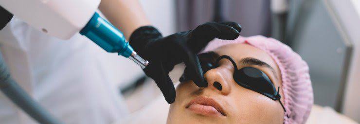 PIGMENTATION Laser Removal Treatments - Vivacious | Beauty Clinic
