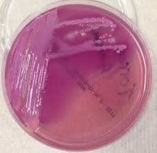 A number of strains have been identified. Microbiology Case Study 38 Year Old With Intermittent Straight Catheterization Lablogatory