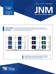 It is estimated that each year 2,000 new cases of mesothelioma are diagnosed. Volumetric Pet Response Assessment Outperforms Conventional Criteria In Patients Receiving High Dose Pembrolizumab For Malignant Mesothelioma Journal Of Nuclear Medicine