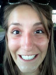 Check spelling or type a new query. I Got Lasik Eye Surgery 4 Years Ago