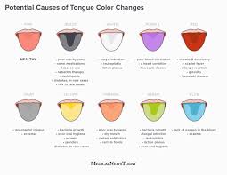 Image result for black tongue symptoms