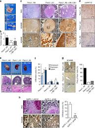We do not host today's loadshedding 1.3.4 on our servers, so we did not scan it for viruses, adware. Adam8 As A Drug Target In Pancreatic Cancer Nature Communications