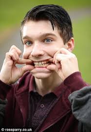 Benefits Britain's Travis Simpkins thinks the show will make him as big as  White Dee