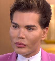 Rodrigo alves has lost five inches off his waistline thanks to his controversial rib removal procedure subscribe to barcroft tv: Rodrigo Alvesuk