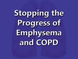 Dr Stanley Monteith Interviews W Greg Miller Author Of How I Reversed My Mom S Emphysema Youtube Copd Treatment Remedies Copd Treatment Healthy Lungs