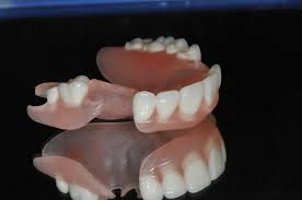 Does insurance cover partial dentures? Flexible Partials Art Dental Lab