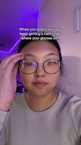 it’s because I’m allergic to a lot of metals and my glasses have metal  where they sit