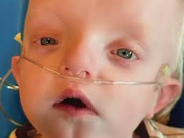 Fundraiser by Webb Travis : Callan Needs Our Help: Unique Medical Challenge