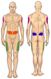 Image result for infermieristica come fare l'iniezione