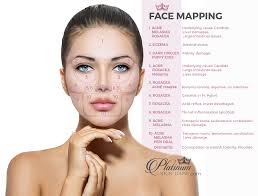 Face Mapping To Solve Skin Issues Platinum Skin Care