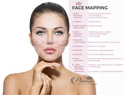 face mapping to solve skin issues platinum skin care