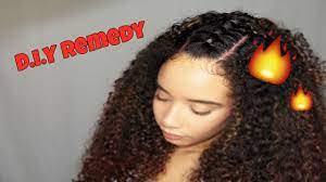 With a dry scalp, there's usually dry hair. How To Treat Dandruff Dry Itchy Scalp For Curly Hair Youtube