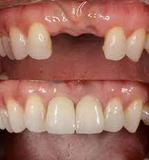 Maybe you would like to learn more about one of these? Gigi Tiruan Dental Office By Dr Peiter